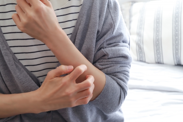 冬の乾燥かゆみ